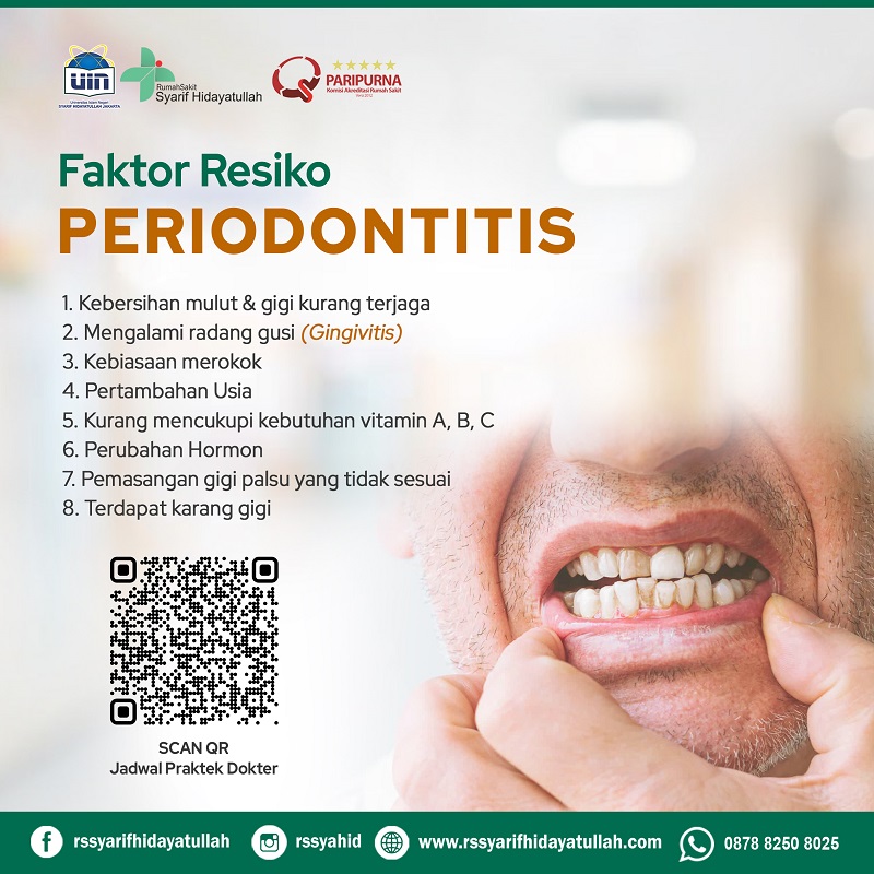 PERIODONTITIS slide 3